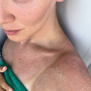 Gilticus Nude